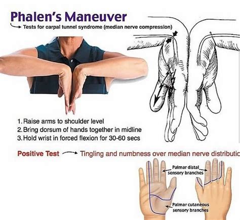 median nerve compression test sensitivity|positive tinel's and phalen's.